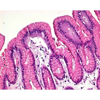 苏木精一水合物 CI 75290 用于显微镜 Thirtystain 115938 25GMerck(默克密理博)1.15938.0025